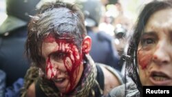 Жертва одного з мітингів у Мадриді
