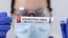 Epruvete sa oznakom "pozitivan na virus majmunskih boginja", 23. maj 2022.