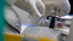 Entoni Fauči, najviši zvaničnik zadužen za zarazne bolesti u SAD, izrazio je zabrinutost zbog navodnih COVID-19 vakcina koje se razvijaju u Rusiji i Kini (fotografija iz jedne od laboratorija za izradu vakcine u Rusiji)