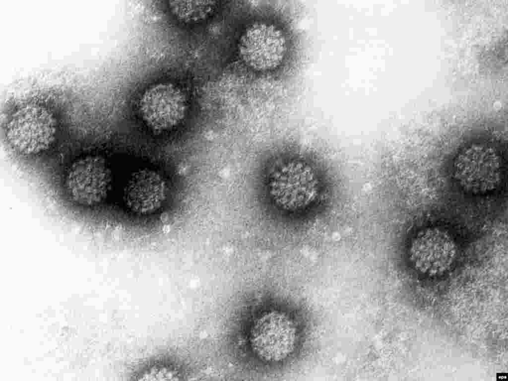 7. Jedna petina karcinoma uzrokovana je hroničnim infekcijama, npr.papiloma virusom i hepatitis B virusom - Foto: Njemački centar za istraživanje u Heidelbergu - papiloma virus, Epa - Deutsches Krebsforschungszentrum